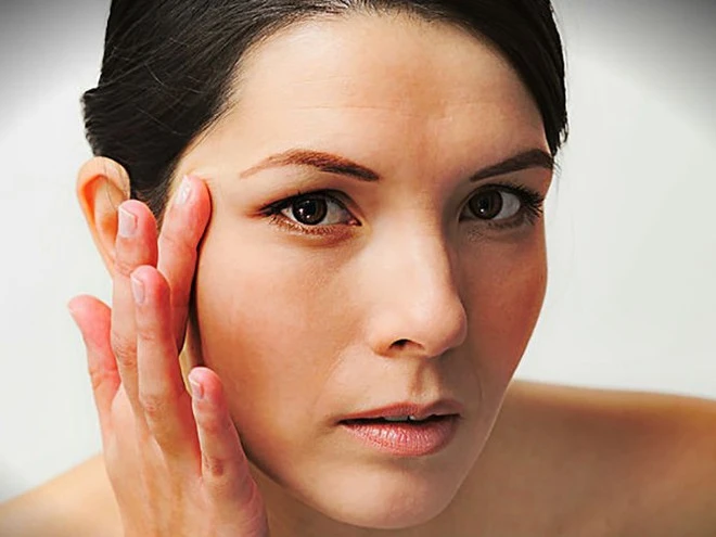 Vitamin C - Miraculous Help treat acne
